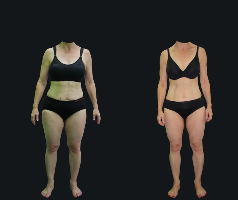 Before and after photos of a real 6X Training member, transformation 1